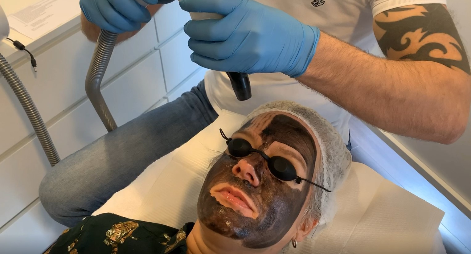 carbon laser peeling cosmediq